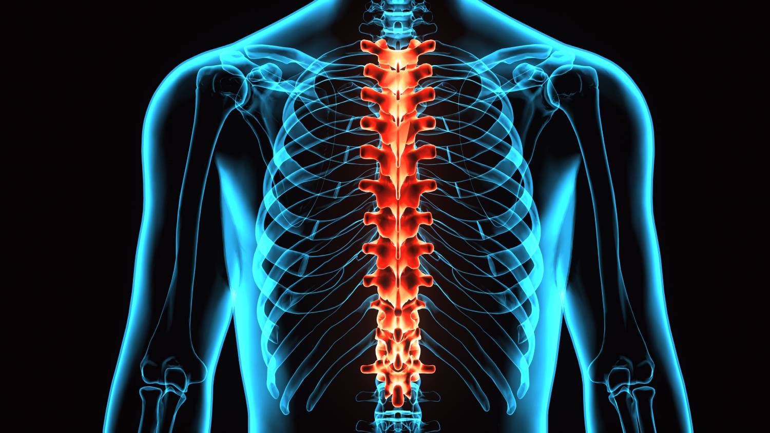 Erector Spinae Plane Block