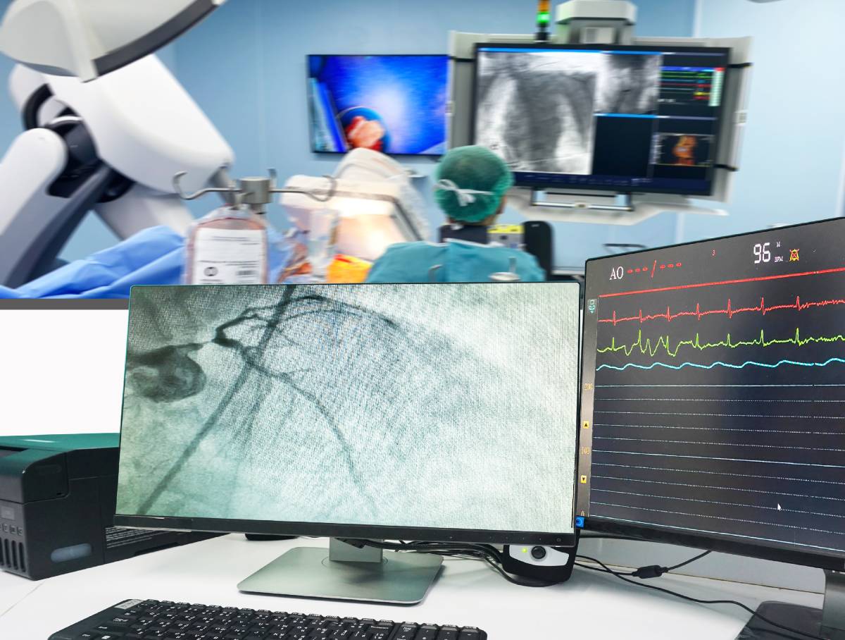 Anesthesia Considerations for Pediatric Cardiac Catheterization