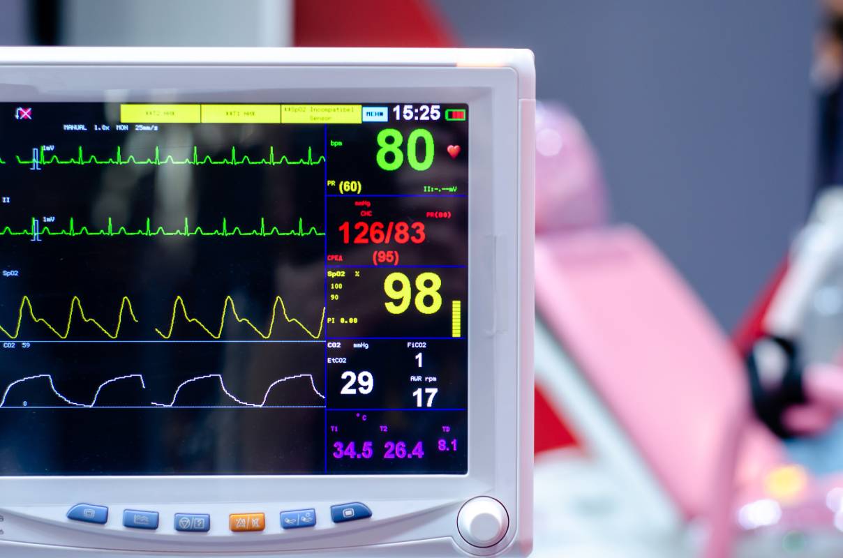 End-Tidal CO2 Monitoring During Anesthesia