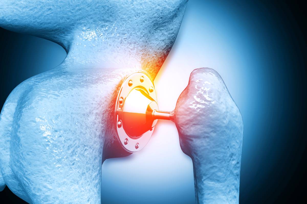 Postoperative Pain Management for Implants