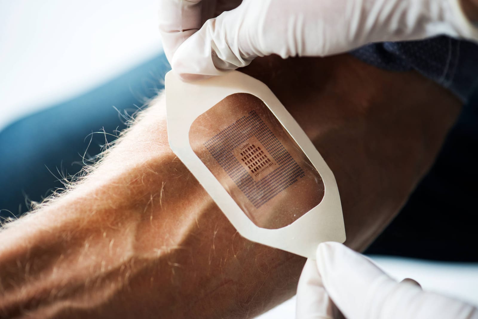 Considerations for Remote Patient Monitoring