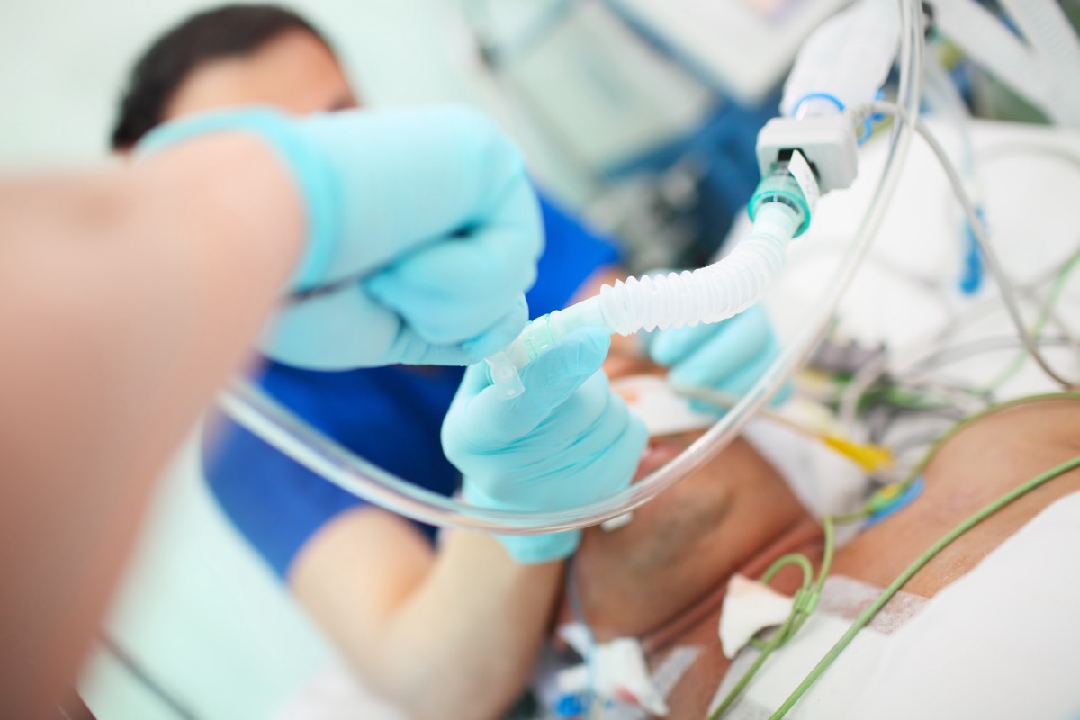 Intubation in the ICU vs. The OR